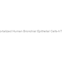 Immortalized Human Bronchial Epithelial Cells-hTERT